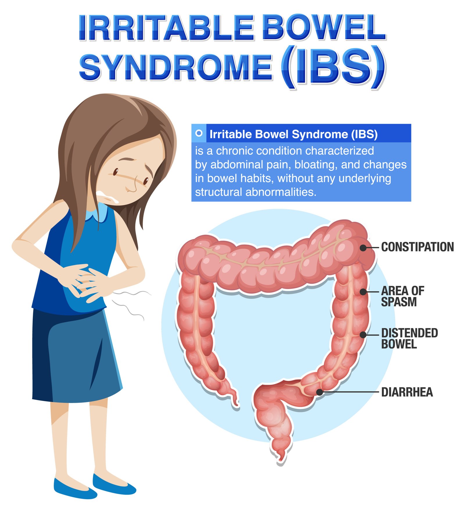 Irritable bowel syndrome IBS